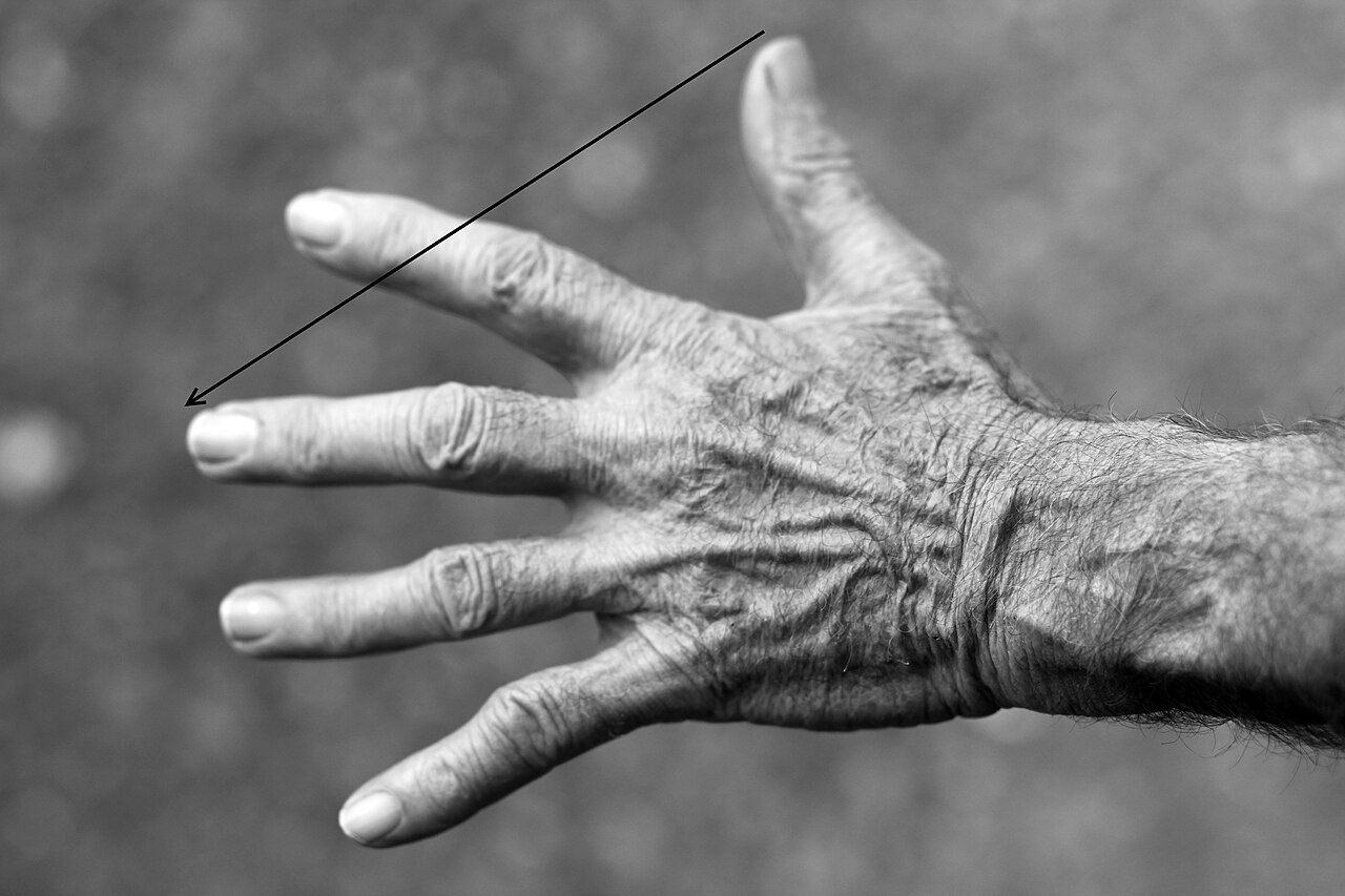 Dul ve Yetim Aylığı Alanlara Ek Ödeme Detayları – Detaylar 291